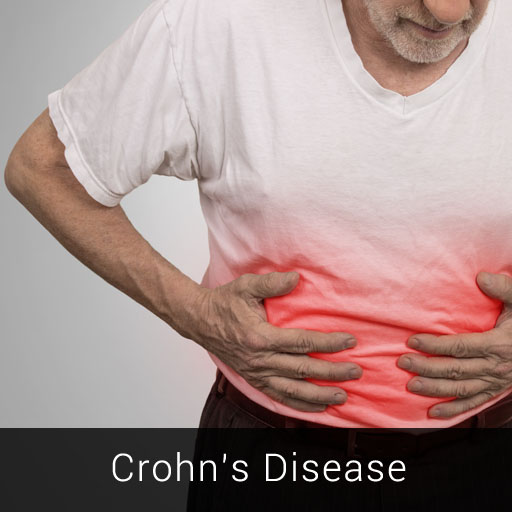 Crohn's Disease
